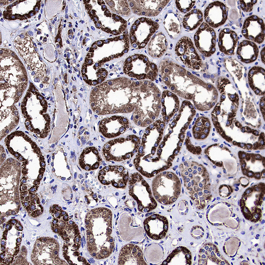 IRF3 Recombinant Rabbit mAb (S-3916-22)