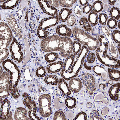 IRF3 Recombinant Rabbit mAb (S-3916-22)