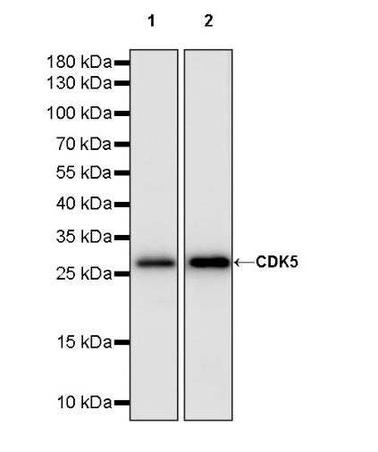 CDK5 Recombinant Rabbit mAb (S-1309-115)