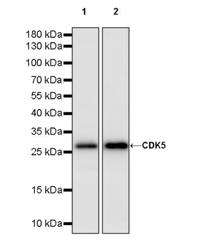 CDK5 Recombinant Rabbit mAb (S-1309-115)