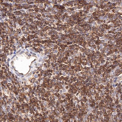 Moesin Rabbit Polyclonal Antibody