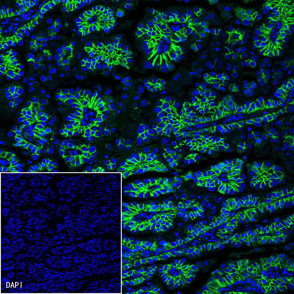 S-RMab® EpCAM Recombinant Rabbit mAb(SDT-078-13)
