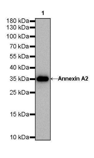 S-RMab®Annexin A2 Recombinant Rabbit mAb (SDT-444-67)