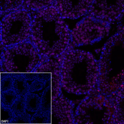Ki67 Recombinant Rabbit mAb (Alexa Fluor® 555 Conjugate) (SDT-R459)