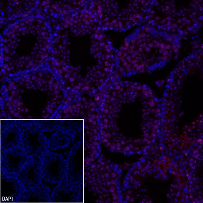 Ki67 Recombinant Rabbit mAb (Alexa Fluor® 555 Conjugate) (SDT-R459)