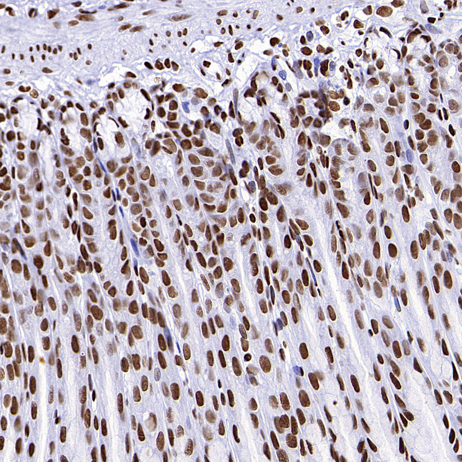 TriMethyl-Histone H3 (K36) Recombinant Rabbit mAb (S-M0025)
