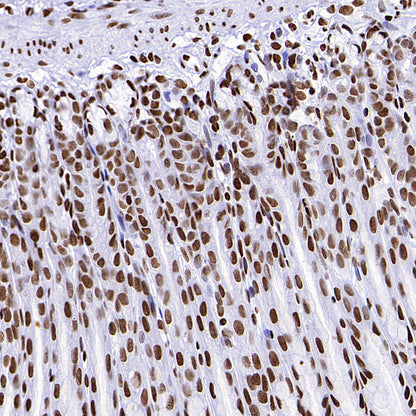 TriMethyl-Histone H3 (K36) Recombinant Rabbit mAb (S-M0025)