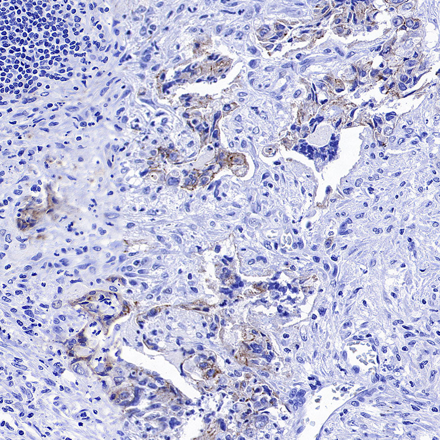 CDH3 Recombinant Rabbit mAb (S-3576-116)