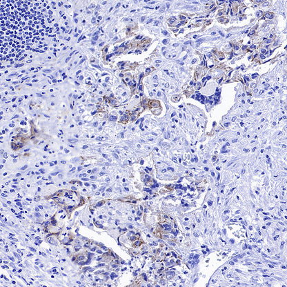 CDH3 Recombinant Rabbit mAb (S-3576-116)