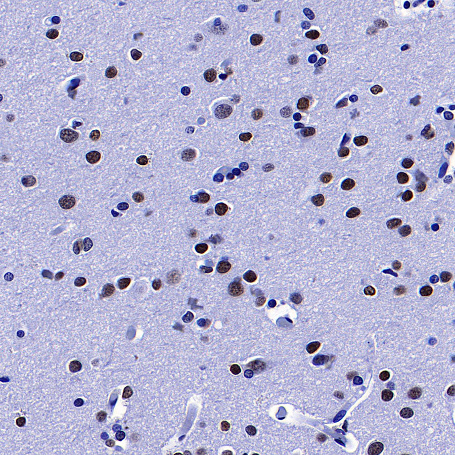 Histone H3 Recombinant Rabbit mAb (S-5672)