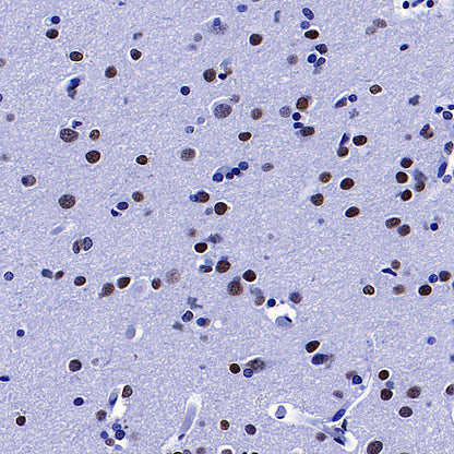 Histone H3 Recombinant Rabbit mAb (S-5672)