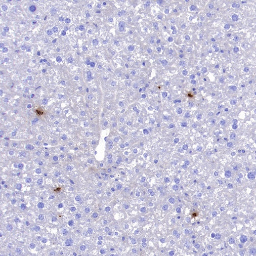 Lipocalin-2/NGAL Recombinant Rabbit mAb (S-2280-129)