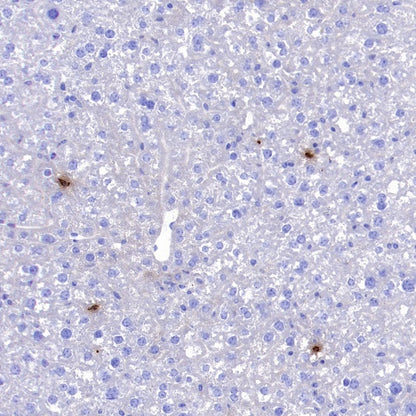 Lipocalin-2/NGAL Recombinant Rabbit mAb (S-2280-129)