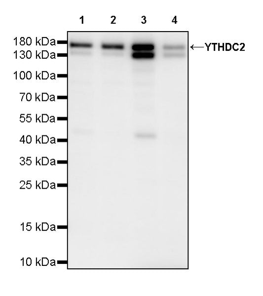 YTHDC2 Recombinant Rabbit mAb (S-3338-41)