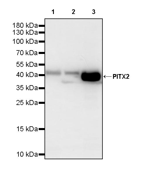 PITX2 Recombinant Rabbit mAb (S-4009-54)