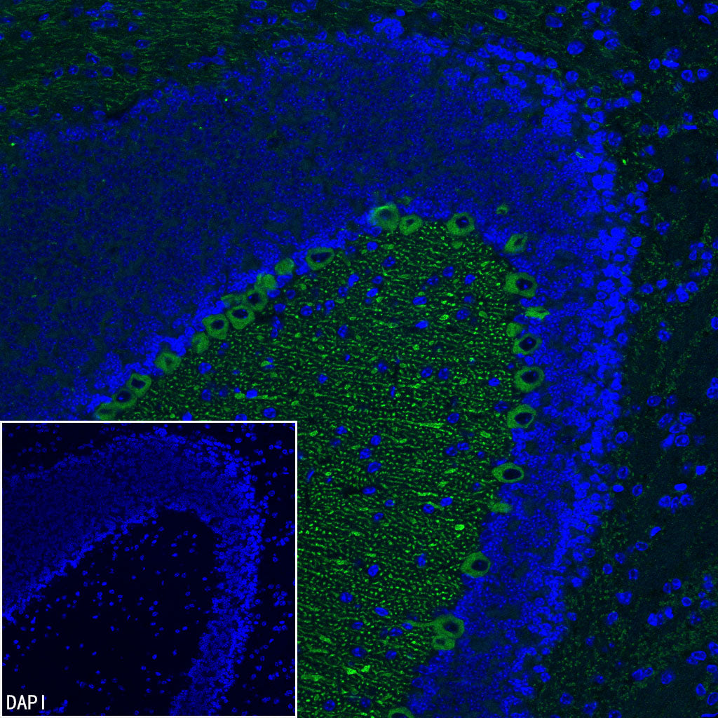 ITPR1 Recombinant Rabbit mAb (S-4530-5)
