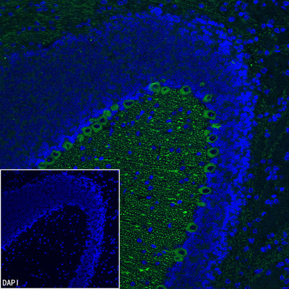 ITPR1 Recombinant Rabbit mAb (S-4530-5)