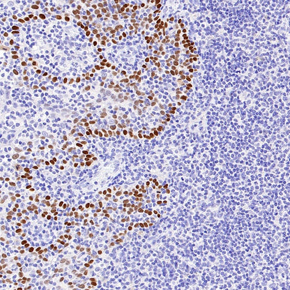 p40 Recombinant Rabbit mAb (SDT-166-116)