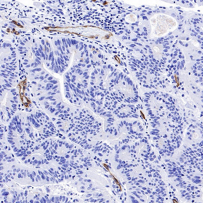 PODXL Recombinant Rabbit mAb (S-2014-9)