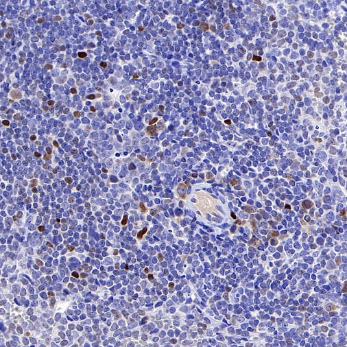 c-Myc Recombinant Rabbit mAb (S-519-54)