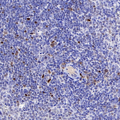 c-Myc Recombinant Rabbit mAb (S-519-54)