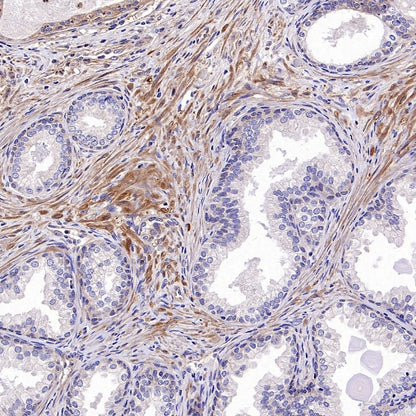 Vinculin Recombinant Mouse mAb (S-916-217)