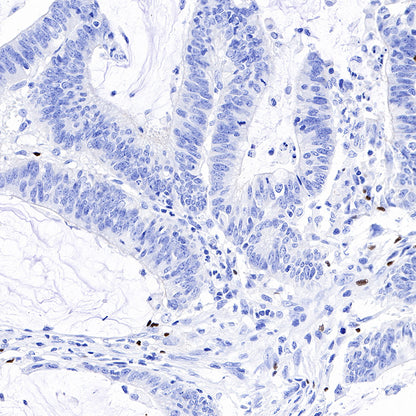 FOXP3 Recombinant Rabbit mAb (SDT-R064)