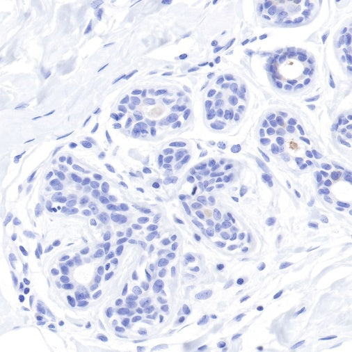 S-RMab® GCDFP-15 Recombinant Rabbit mAb (SDT-R030)