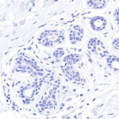 S-RMab® GCDFP-15 Recombinant Rabbit mAb (SDT-R030)