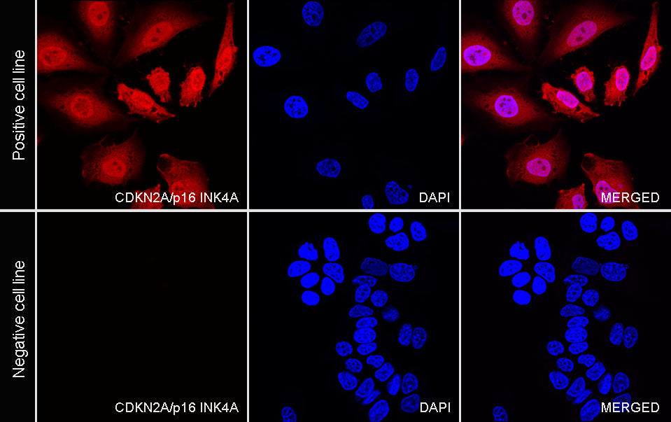 CDKN2A/p16 INK4A Recombinant Mouse mAb (Alexa Fluor® 555 Conjugate) (SDT-4675)