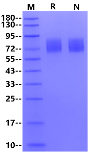 IFN-alpha/beta R1 His Tag Protein, Human