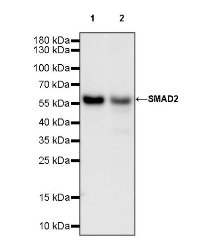 SMAD2 Recombinant Rabbit mAb (S-1420-20)
