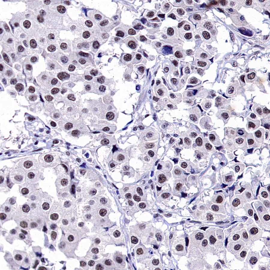 DGCR8 Recombinant Rabbit mAb (S-4082-6)
