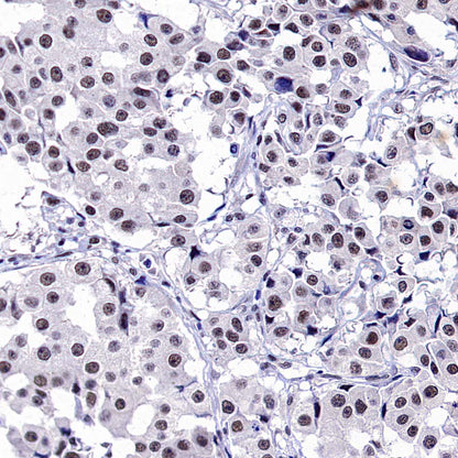 DGCR8 Recombinant Rabbit mAb (S-4082-6)
