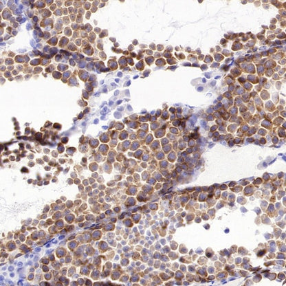 RNF17 Recombinant Rabbit mAb (S-3660-61)
