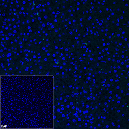 SLC7A5 Recombinant Rabbit mAb (S-4496-55)