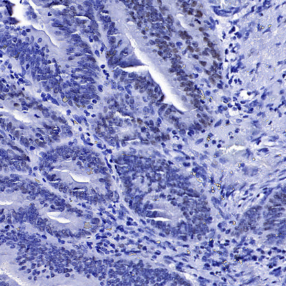 Cyclin E1 Recombinant Rabbit mAb (SDT-4375-29)