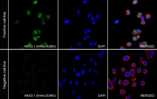 NKX3.1 Recombinant Rabbit mAb (S-2778-63)