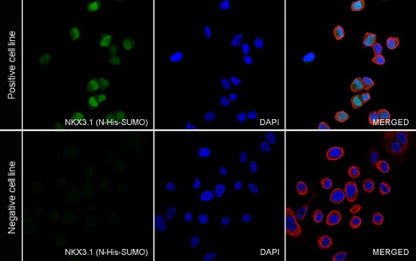 NKX3.1 Recombinant Rabbit mAb (S-2778-63)