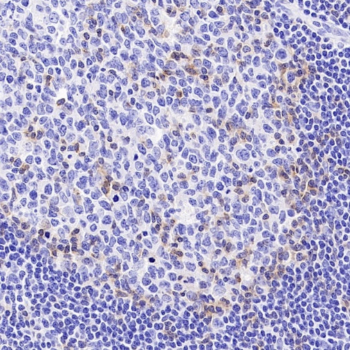 TIGIT Recombinant Rabbit mAb (S-4600)