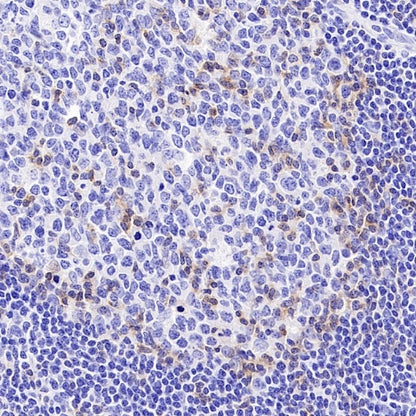 TIGIT Recombinant Rabbit mAb (S-4600)