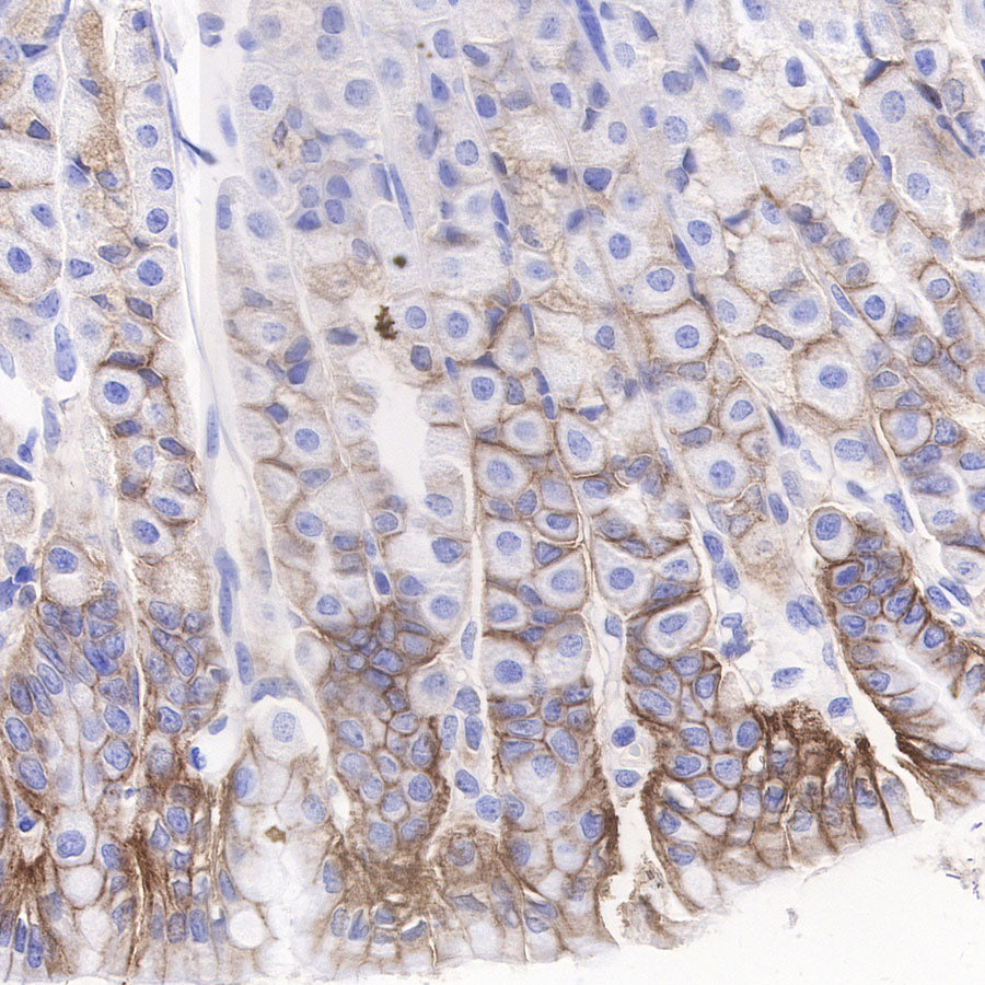 CAIX Recombinant Rabbit mAb (SDT-356-21)