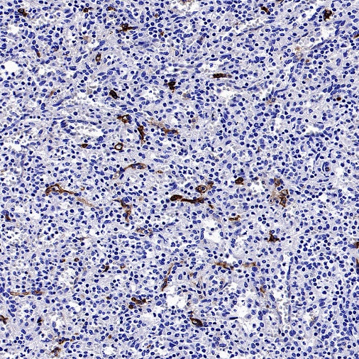 Angiotensin Converting Enzyme 1 Recombinant Rabbit mAb (SDT-2662-122)