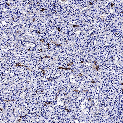 Angiotensin Converting Enzyme 1 Recombinant Rabbit mAb (SDT-2662-122)