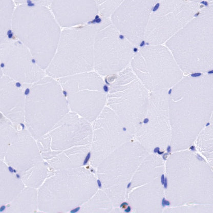 VISTA Recombinant Rabbit mAb (S-1469-72)