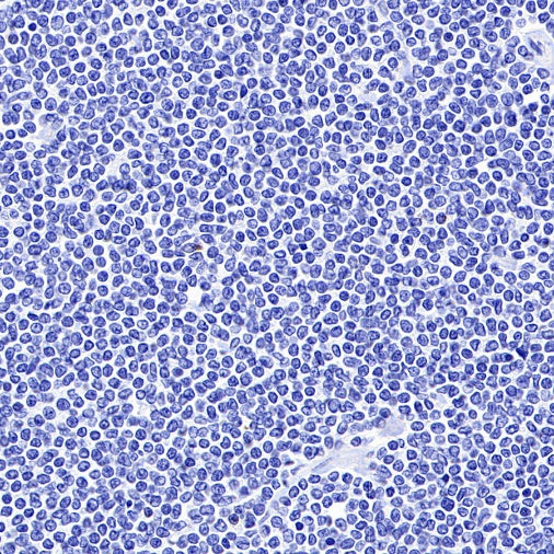 LAG3 Recombinant Rabbit mAb (S-671-74)