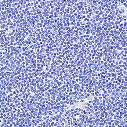 LAG3 Recombinant Rabbit mAb (S-671-74)