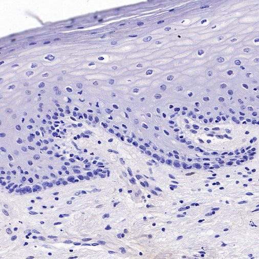 CDKN2A/p16 INK4A Recombinant Rabbit mAb (S-4676)