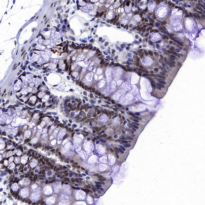 OGT Mouse mAb