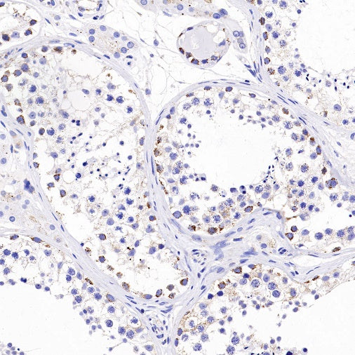 TFAM Recombinant Rabbit mAb (S-1018-53)